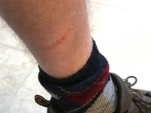 Fender strut casualty!