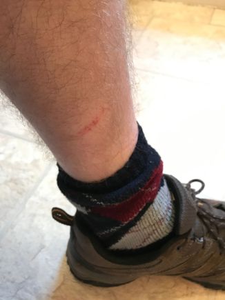 Fender strut casualty!