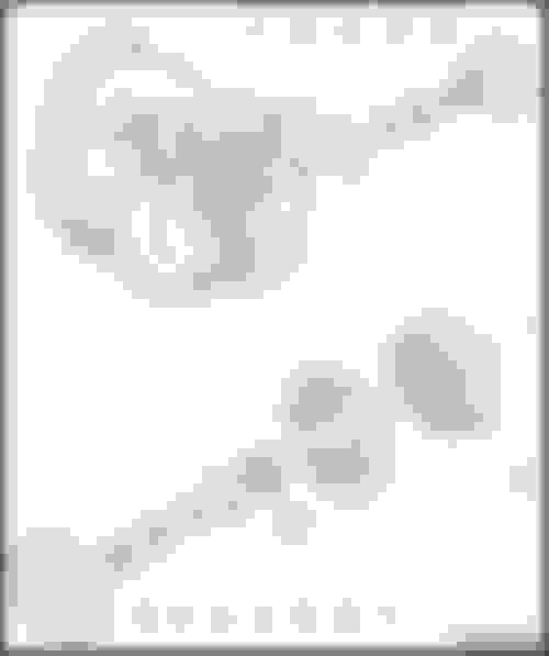 Transmission install won't mate with engine AudiWorld Forums