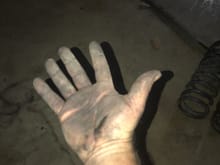 Why do my hands look like this every day?