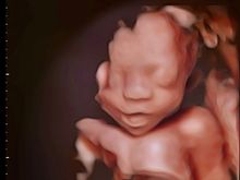 November, Colorado, 4K ultrasound our first Grand baby. ❤️❤️