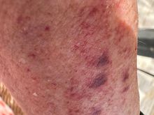 A dotty arm.....what in the world are these spots??