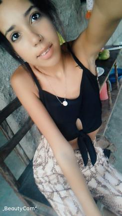 Yania, the 20 year old half-sister of Delenys. She's also now suffering from the residual joint and bone ache symptoms after contracting the chikungunya virus recently.  