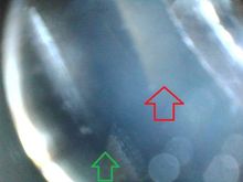 green arrow edge of valve. red arrow valve seat?