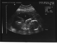 Ourgrowingfetus