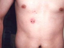 surfacethirdnipple.jpg